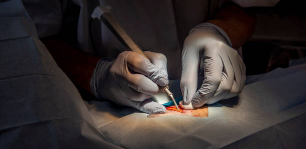 Minor Surgery